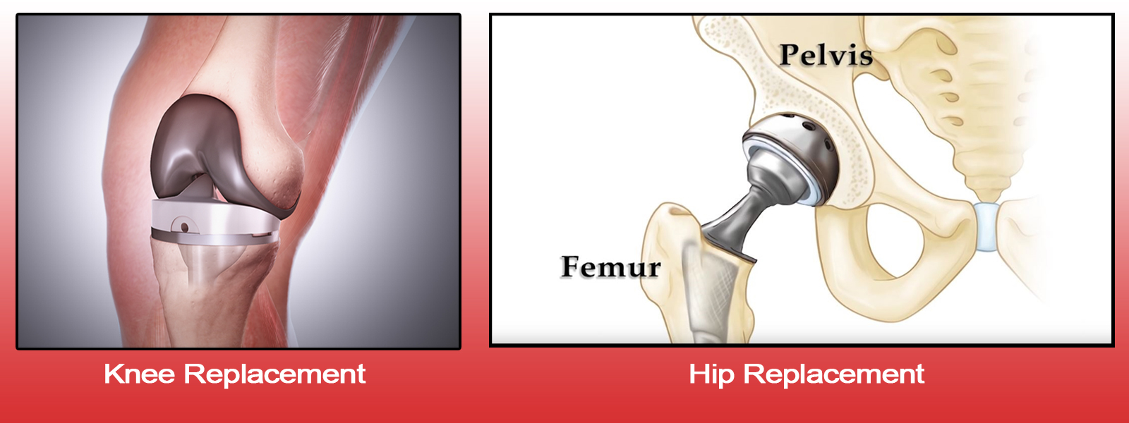 Orthopaedic Surgeon in Vaishali nagar Jaipur