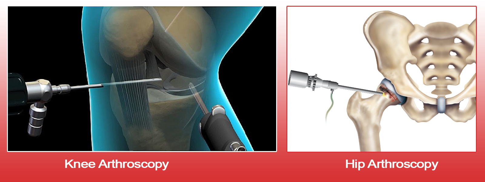 Orthopaedic Surgeon in Vaishali nagar Jaipur